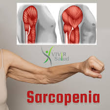 Sarcopenia